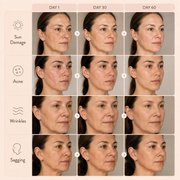 CLEMEN Pro LED Face Mask
