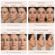 CLEMEN Pro LED Face Mask